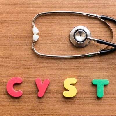 Pilonidal Cyst's symptoms